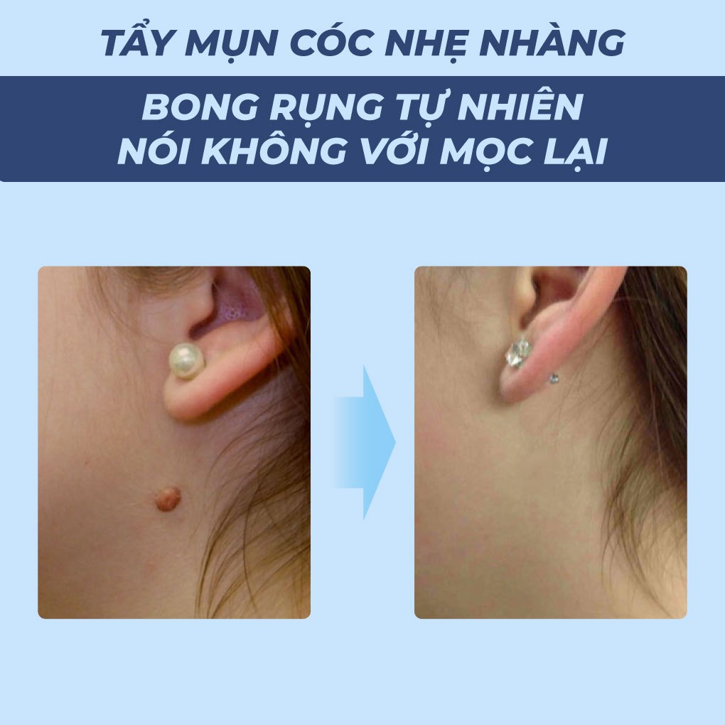 Serum chấm bôi mụn cóc mụn thịt vết chai sần an toàn và hiệu quả Bellena Skin Smooth Serum