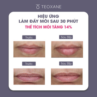 [Sample 1.5ml] Son dưỡng môi Teoxane 3D LIPS