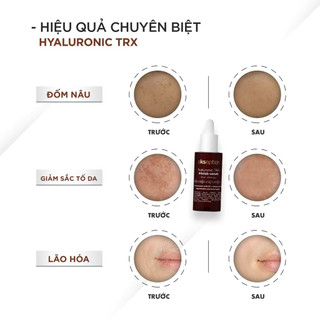Serum Dành Cho Da Nám, Sạm Ekseption Hyaluronic TRX Mixlab Serum 75ml