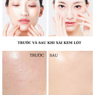 Serum AHA 30% + BHA 2% Peeling Solution 32ml, Tẩy tế bào chết hóa học, làm sáng da, giảm mụn ẩn, mụn đầu đen.