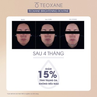 Kem chống nắng phổ rộng, chống tia UVA cực cao TEOXANE UVA SHIELD SPF50+ PA++++ 50ml