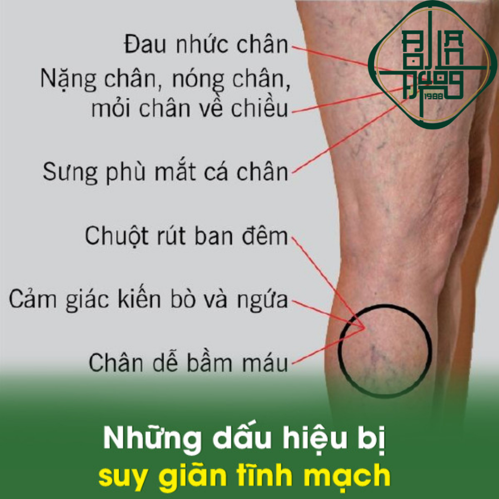 Trà Thảo Mộc Bội Lan Đường Giúp Phục Hồi Suy Giãn Tĩnh Mạch Làm Xẹp Tĩnh Mạch Sưng Phù Nổi Dưới Da