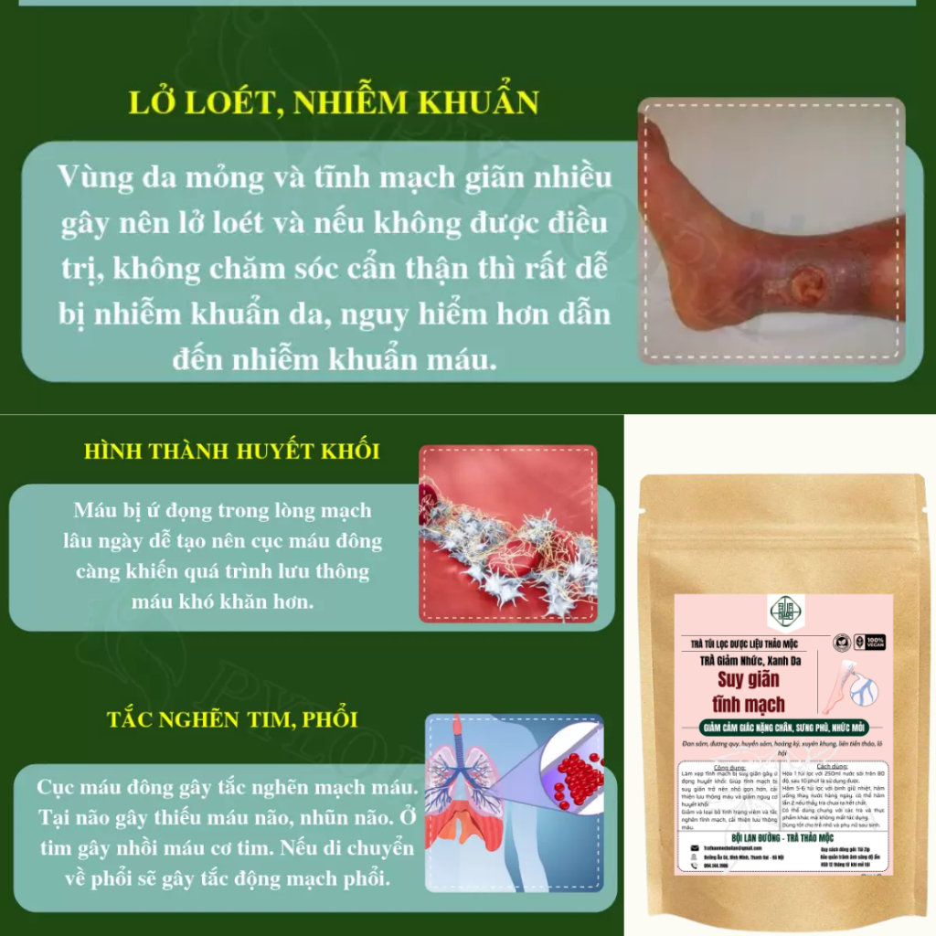 Trà Thảo Mộc Bội Lan Đường Giúp Phục Hồi Suy Giãn Tĩnh Mạch Làm Xẹp Tĩnh Mạch Sưng Phù Nổi Dưới Da