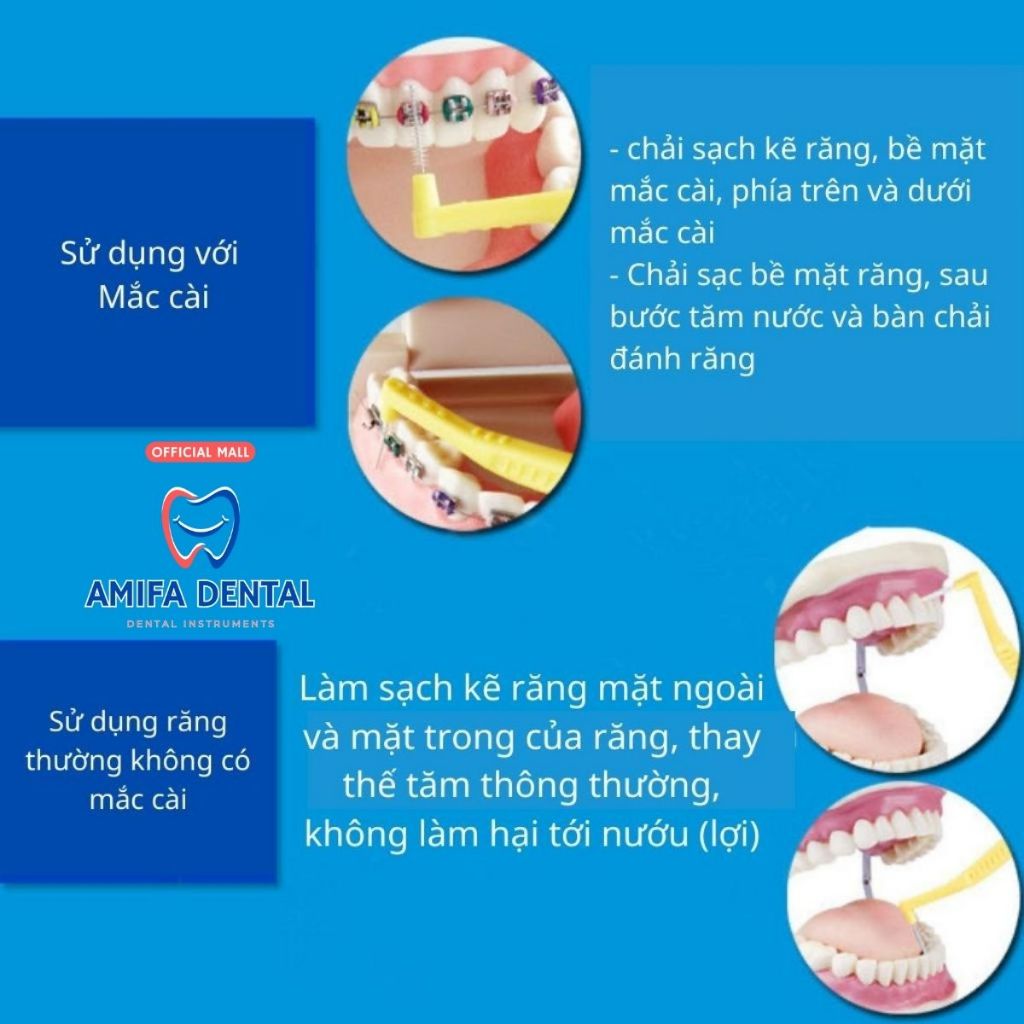 Bàn Chải Kẽ Răng Chữ L Xịn, Bàn Chải Kẽ Vệ Sinh Răng Niềng, Bàn Chải Làm Sạch Kẽ Răng Đủ Size Đủ Màu