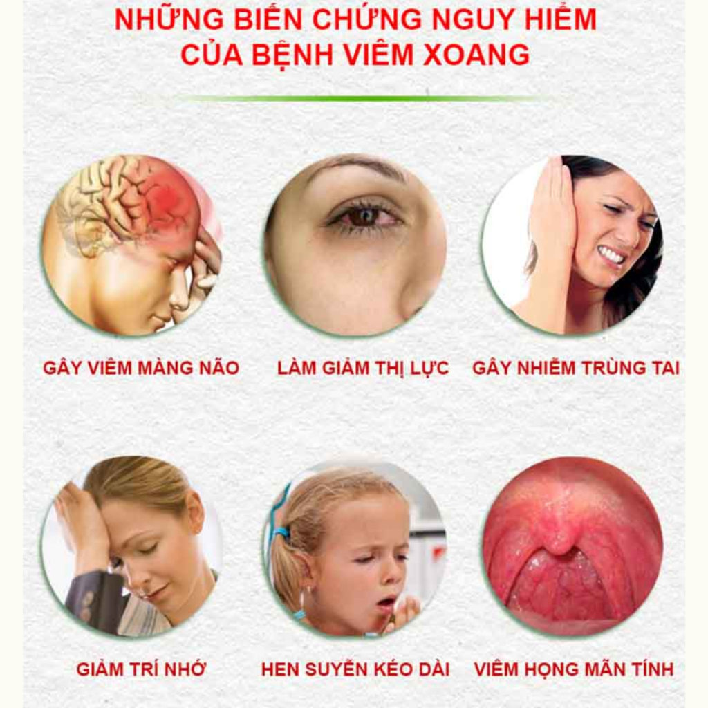 Trà Hỗ Trợ Xoang Mũi Bội Lan Đường - Thông Mũi Dễ Thở, Dứt Điểm Sổ Mũi Xoang Cấp Và Mãn Tính