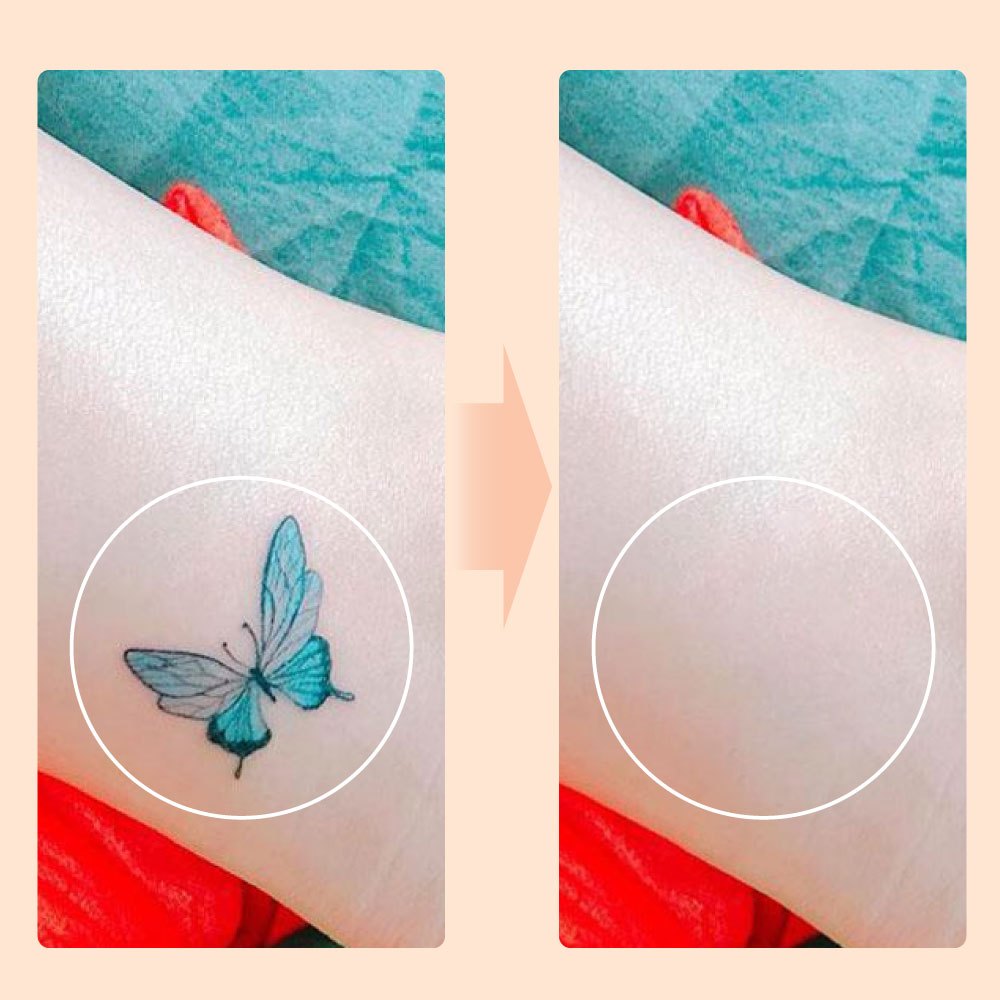 Miếng dán che hình xăm tiệp màu da đậm màu sử dụng được 1 tuần Bellena X3