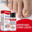 Tinh Chất Phục Hồi Móng,Giảm Bệnh Nấm Móng Nhanh Chóng Và Hiệu Quả,Giúp Kháng Khuẩn, Loại Onychomycosi, Làm Dày, Mềm Mại