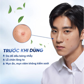 Sữa rửa mặt tràm trà cho da mụn Dr.for Skin Tea Tree