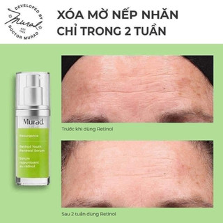 Tinh Chất Retinol Chống Lão Hóa, Tái Tạo Da Murad Retinol Youth Renewal Serum 30ml