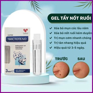 Gel Tẩy Nốt Ruồi DVELINIL Nga Tẩy Nốt Ruồi, Mụn Cơm, Mụn Cóc, Mụn Thịt