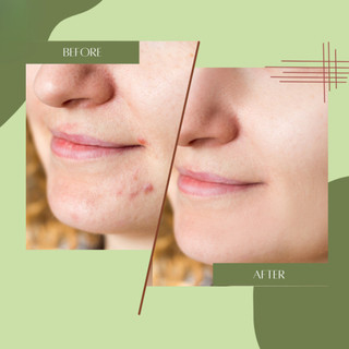 BÔNG MÚT TRÒN 1 BỊCH 20 MIẾNG , SIÊU TIẾT KIỆM , TIỆN DỤNG,DỄ SỬ DỤNG