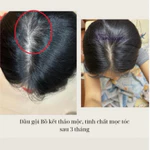 COMBO SIÊU GIẢM DẦU,GÀU, SIÊU MỌC TÓC ( 1 dầu gội hoa khô 500ML + 1 Ủ tóc bơ hạt mỡ 200ML + 1 tinh chất thảo mộc 100ml) — ảnh 6