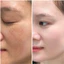 Sữa Rửa Mặt Cân Bằng MESO BALANCING CLEANSER 3IN1 Sữa Rửa Mặt, Tẩy Trang, Toner Thích Hợp Cho Làn Da Nhạy Cảm