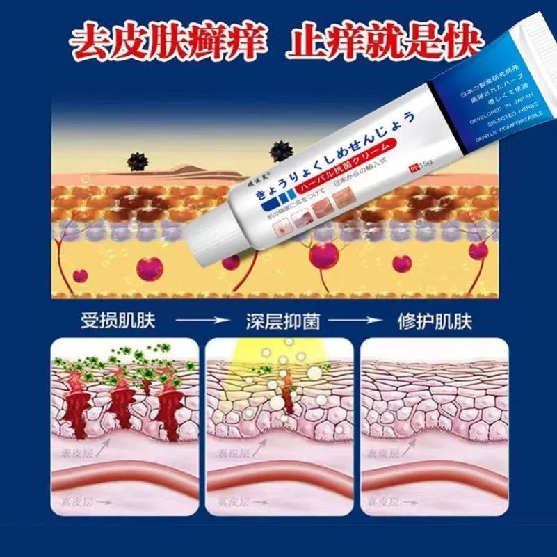 Kem Bôi Nấm Ngứa Viêm Da Cơ Địa NHẬT BẢN Hắc Lào, Tổ Đỉa, Vẩy Nến, Á Sừng, Lang Ben Hiệu Quả