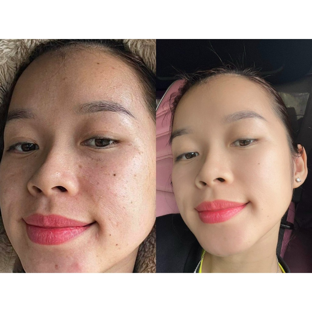 Kem Phục Hồi Đa Tầng Derma Calm Cream Của Jordan - Giảm Mụn - Trẻ Hóa _ Căng Bóng Làn Da Tuýp 75g
