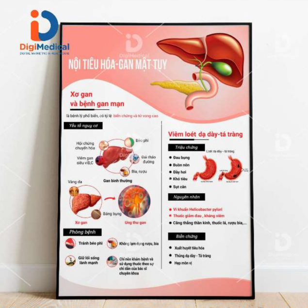 (Decal Dán) Tranh Nội Tiêu Hóa Gan Mật Tụy - Sơ Gan Và Bệnh Gan Mạn ...