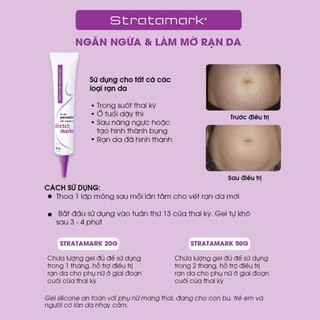Gel Silicone ngăn ngừa và làm mờ rạn da Stratamark
