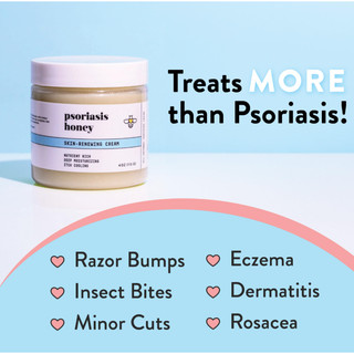Kem tái tạo da Psoriasis HONEY cho da nhạy cảm - Kem vẩy nến cho da ngứa Relieve