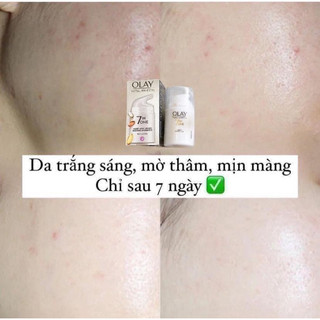 Kem dưỡng Olay Total Effects 7in1