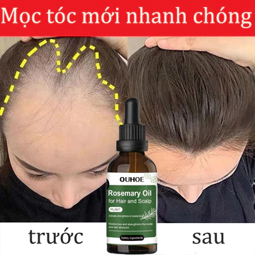 Serum mọc tóc tinh dầu mọc tóc Tinh chất mọc tóc Tinh Chất Chống Rụng Tóc Kích thích tóc mọc nhanh và giảm rụng tóc