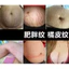 SERUM MỜ RẠN DA - MỜ SẸO HUNMUI - Serum Tái Tạo Da Hunmui Đông Y Tinh Chất Dầu Oliu và Hạt Hướng Dương 40ml