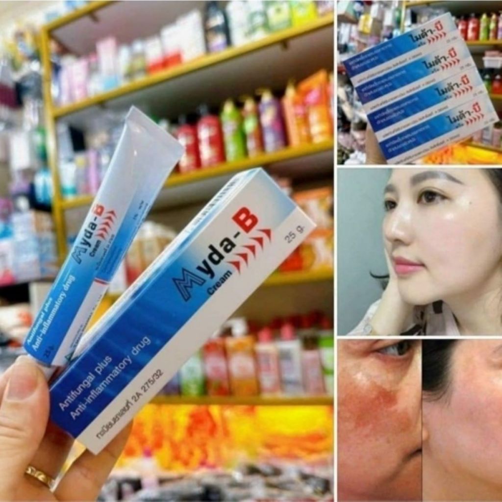Kem dưỡng da nám , tàn nhang Myda-B 15g - 25g chính hãng