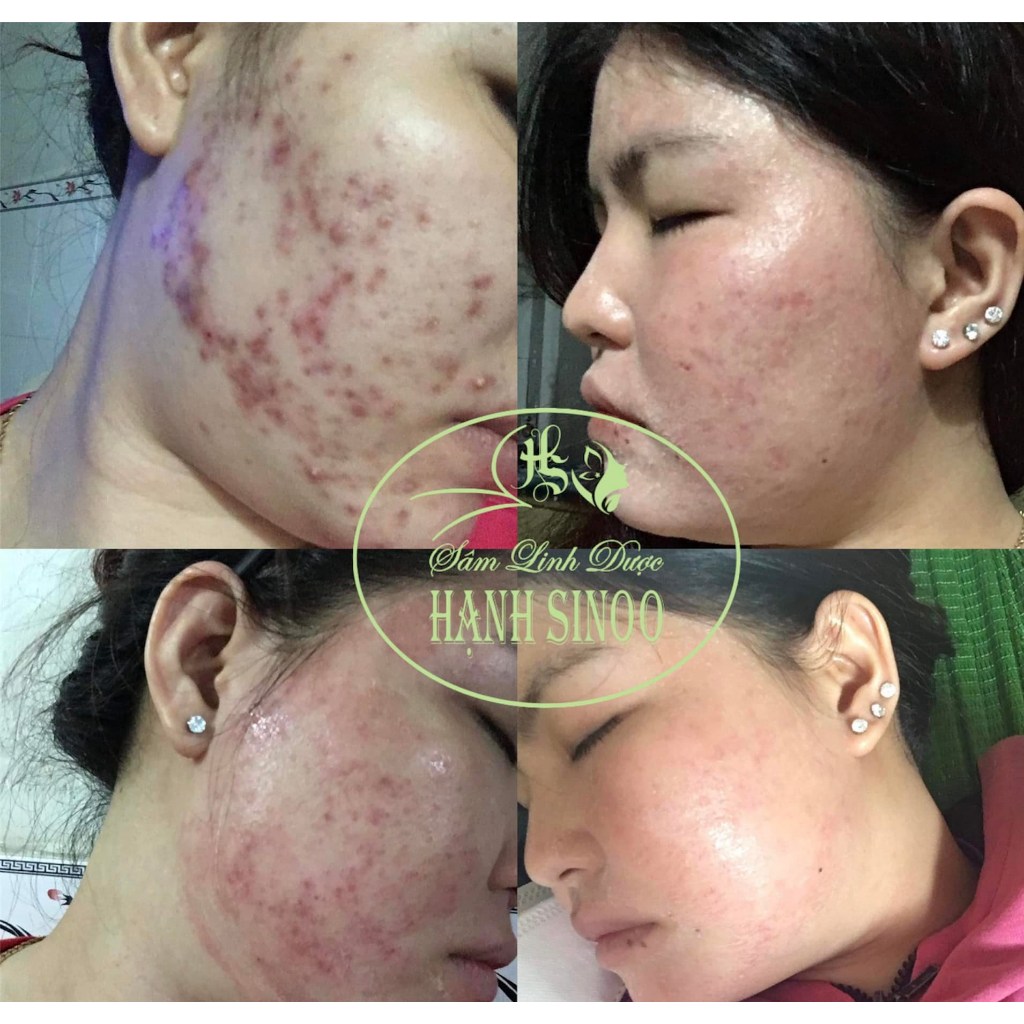 Tái tạo Bột sâm đông y Hạnh Sino 100% thiên nhiên lành tính - Hỗ trợ da khoẻ đẹp căng bóng từ gốc - Handmade