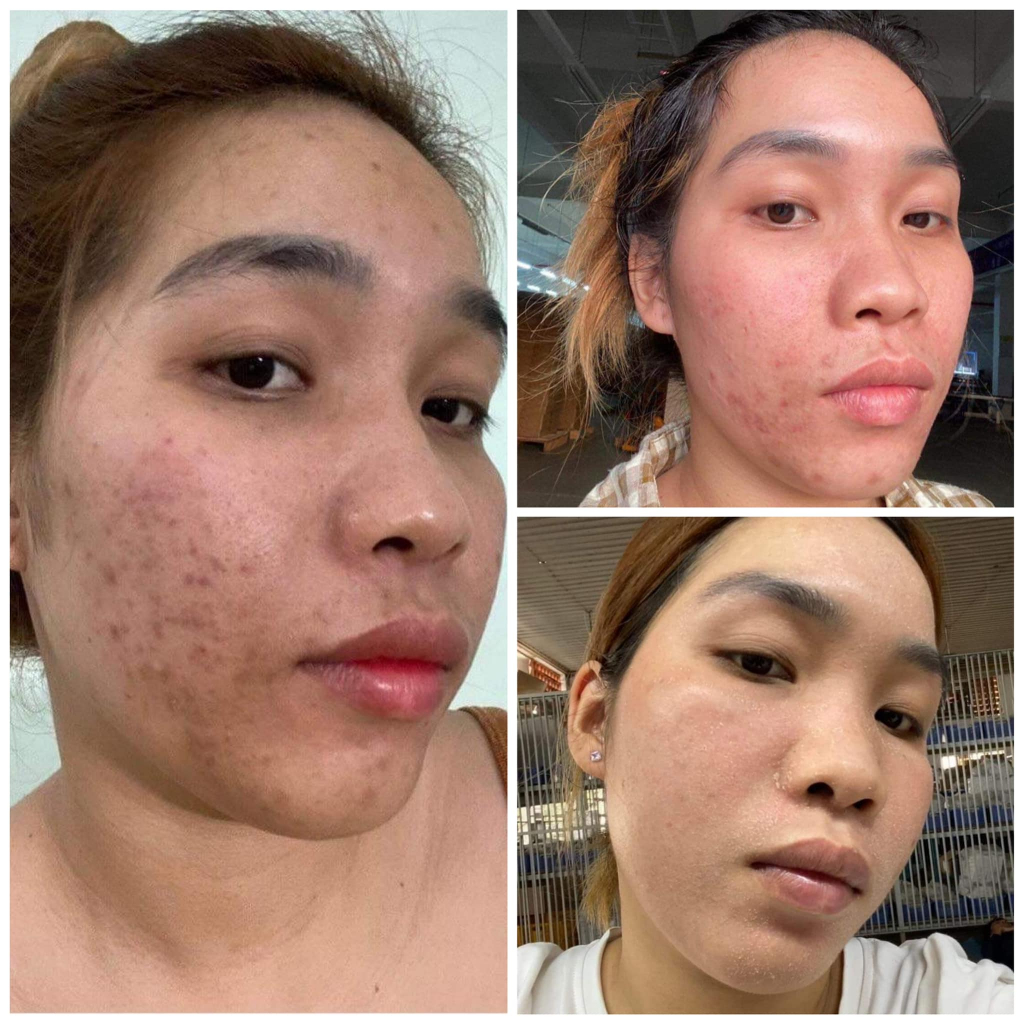 Tái tạo Bột sâm đông y Hạnh Sino 100% thiên nhiên lành tính - Hỗ trợ da khoẻ đẹp căng bóng từ gốc - Handmade