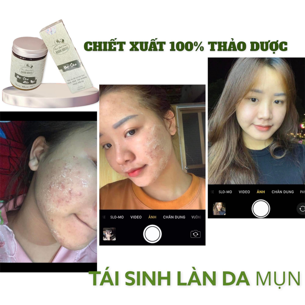 Tái tạo Bột sâm đông y Hạnh Sino 100% thiên nhiên lành tính - Hỗ trợ da khoẻ đẹp căng bóng từ gốc - Handmade