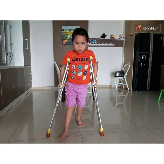 NẠNG KẸP NÁCH NHÔM DÀNH CHO TRẺ EM 1M3 - 1M50 ( 1 CÁI )