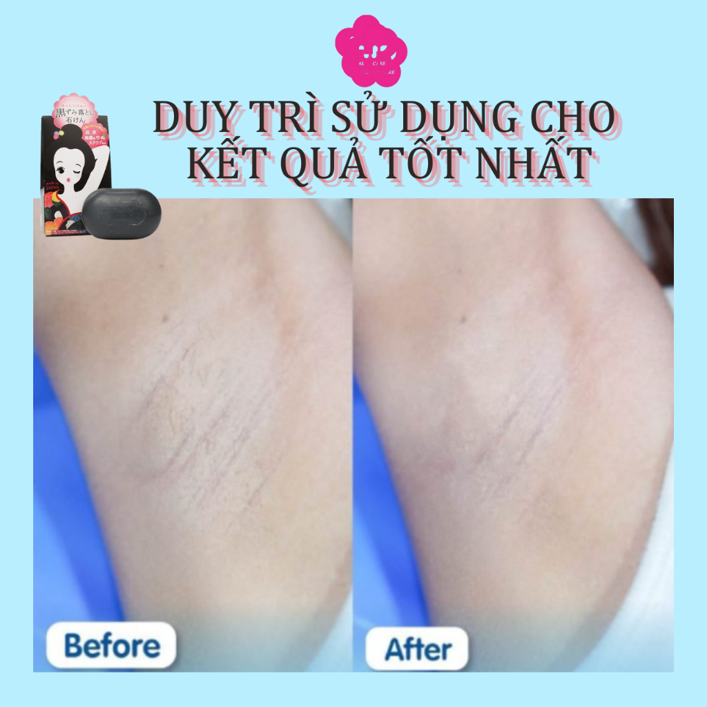Xà Phòng Tắm Dưỡng Trắng , Ngừa Thâm Nách Pelican Soap (100g)