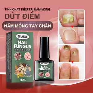 Serum Nấm Móng Tay Chân ELLHOE Hết Sạch Nấm, Bọng Móng, Hư Khoé, Nước Ăn Tay Chân, Dưỡng Cứng Móng