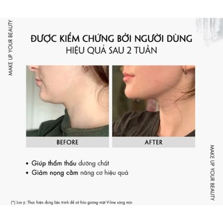 Bộ Đá Guasha Bằng Đá Tự Nhiên Màu Xanh Ngọc Bích Kèm Cây Lăn Đá Tự Nhiên Cùng Màu Giúp Nâng Cơ Da - Massage Thư Giãn
