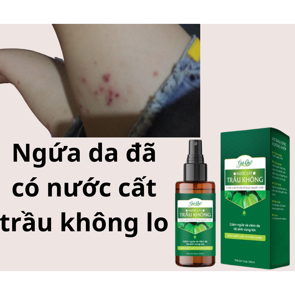 Nước cất trầu không giảm ngứa, đau họng, đau răng