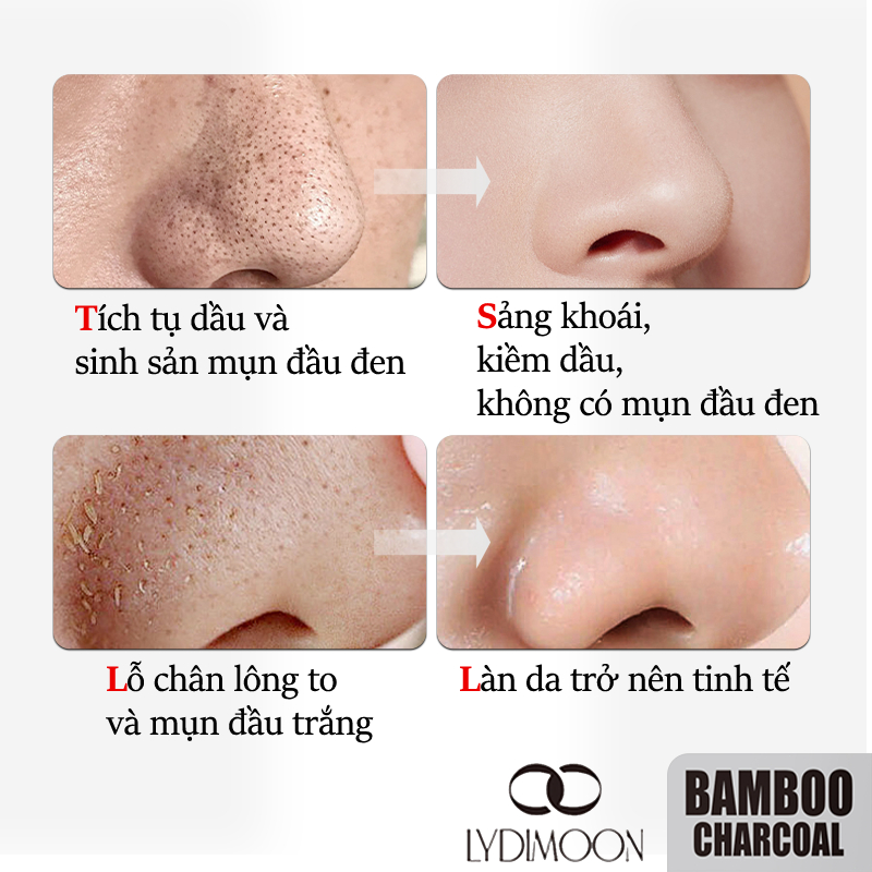 Mặt nạ lột mụn đầu đen than tre Loại bỏ mụn đầu đen mụn trứng cá Giảm tiết dầu trên da 60ml