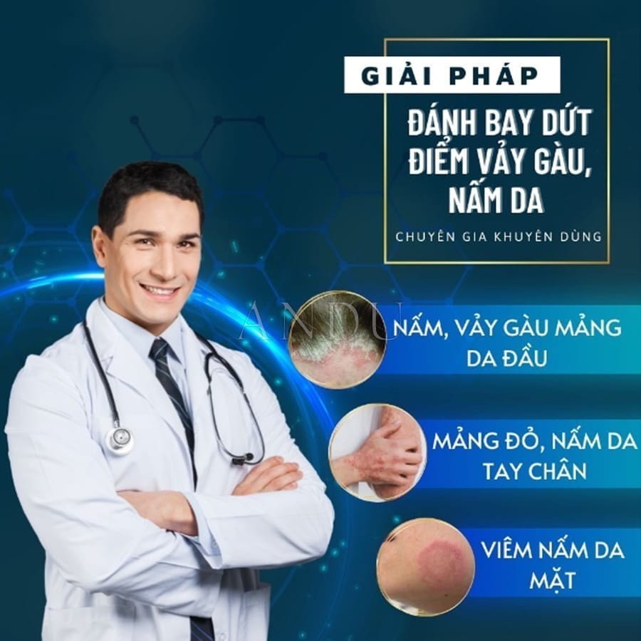 Kem Bôi Nấm Ngứa Viêm Da Cơ Địa NHẬT BẢN Hắc Lào, Tổ Đỉa, Vẩy Nến, Á Sừng, Lang Ben Hiệu Quả
