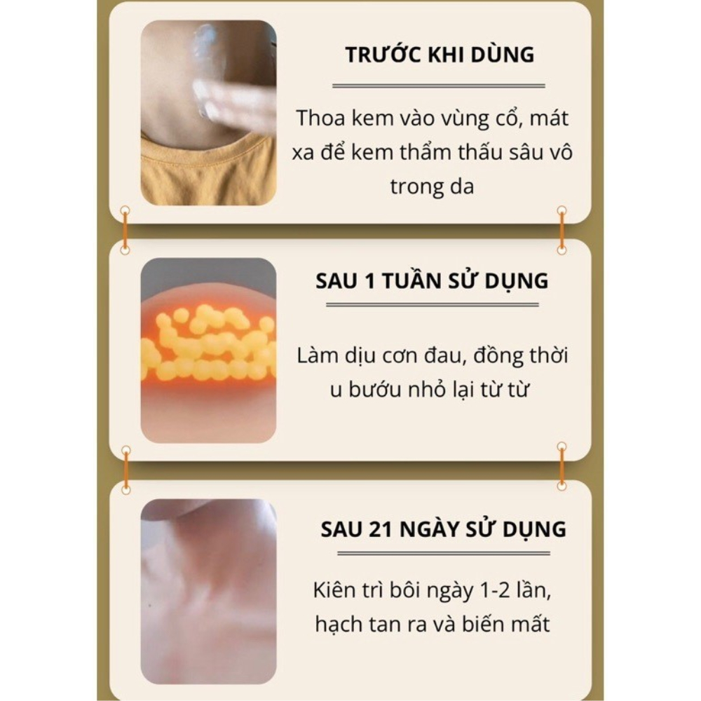 Kem Tan Hạch Bạch Huyết Nhật Bản - Hỗ Trợ Teo Hạch, Lưu Thông Mạch Máu, Giảm Bướu Cổ Hiệu Quả