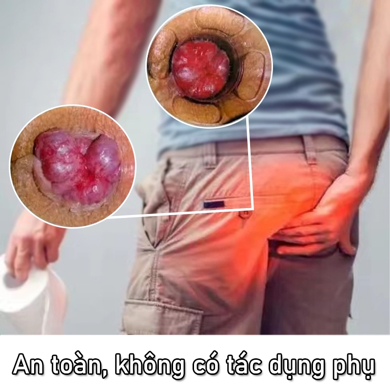 Kem bôi bệnh trĩ, giảm sưng đau vùng hậu môn, tiêu sưng, cầm máu và làm co búi trĩ, dùng cho cả nam và nữ