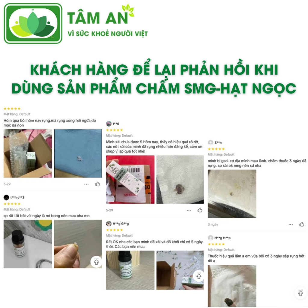 Tinh Chất Thảo Mộc Hỗ Trợ Xử Lý Hạt Ngọc, Mụn Li Ti Nam Giới - An Mộc Nhiên 10ml