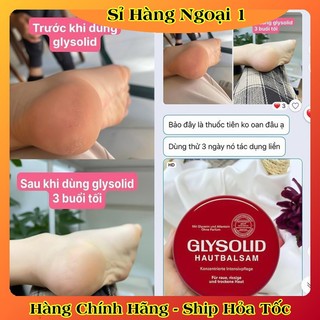 [auth] Kem dưỡng ẩm Glysolid Hautbalsam, 100 ml của Đức [Hot]