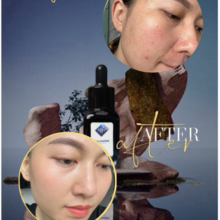 Serum B3, B5 dưỡng ẩm đa tầng, làm mềm mịn,  đều màu da, hỗ trợ giảm thâm, nám serum Aquamarine 20ml