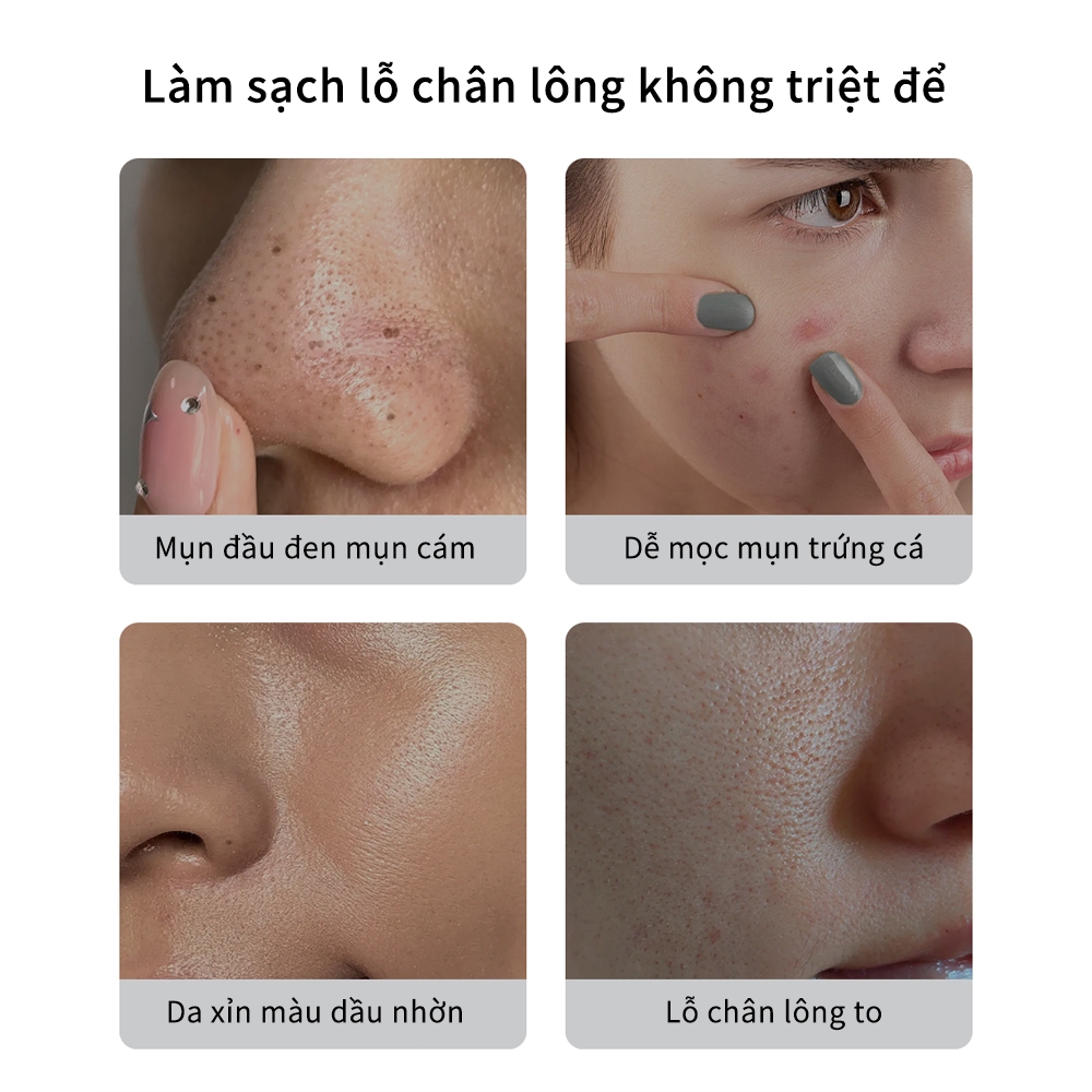 Mặt nạ lột mụn đầu đen than tre Loại bỏ mụn đầu đen mụn trứng cá Giảm tiết dầu trên da 60ml