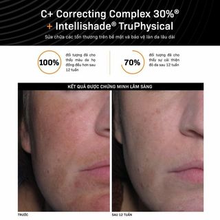 Tinh Chất Vitamin C Revision Dưỡng Trắng Da, Chống Oxy Hóa Revision C+ Correcting Complex 30% 30ml