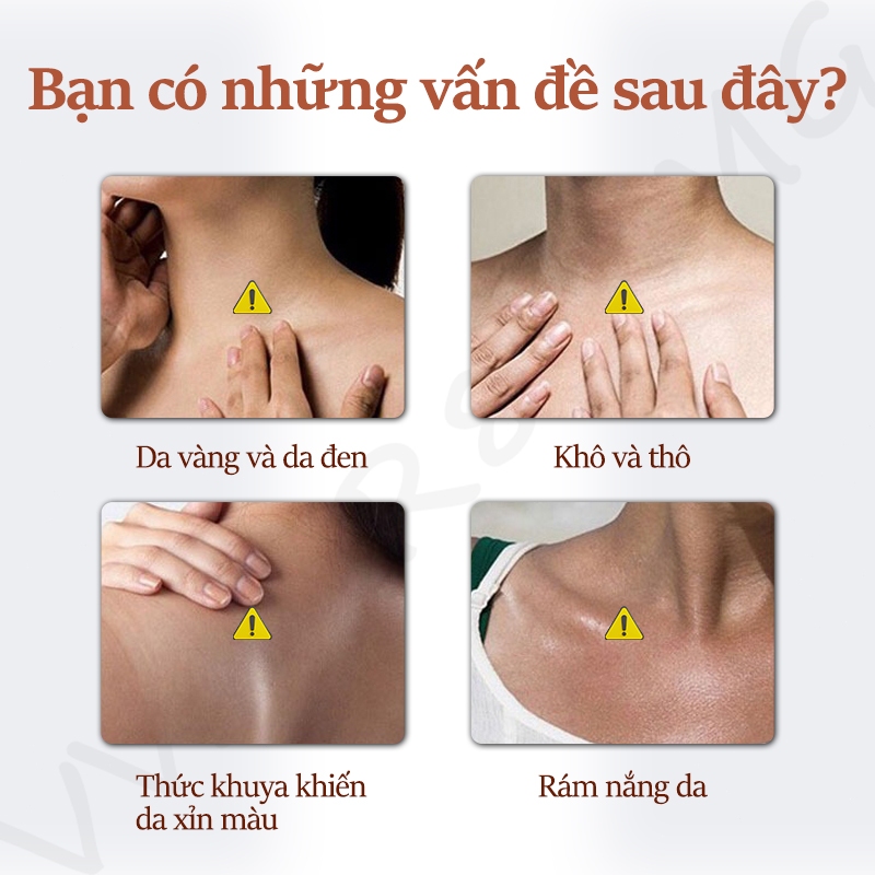 Niacinamide Dưỡng Thể Trắng Da Sữa Dưỡng Thể Alpha Arbutin 300g Làm trắng Dưỡng ẩm Phục hồi da