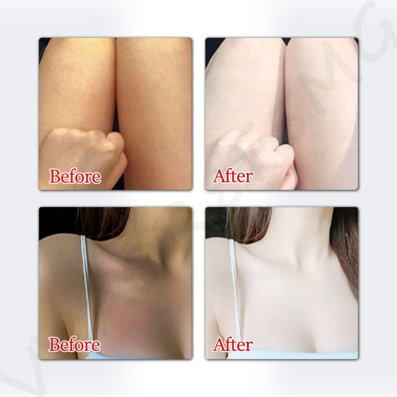 Niacinamide Dưỡng Thể Trắng Da Sữa Dưỡng Thể Alpha Arbutin 300g Làm trắng Dưỡng ẩm Phục hồi da
