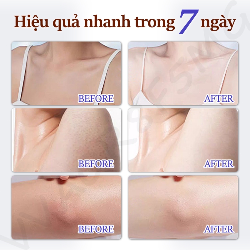 Niacinamide Dưỡng Thể Trắng Da Sữa Dưỡng Thể Alpha Arbutin 300g Làm trắng Dưỡng ẩm Phục hồi da