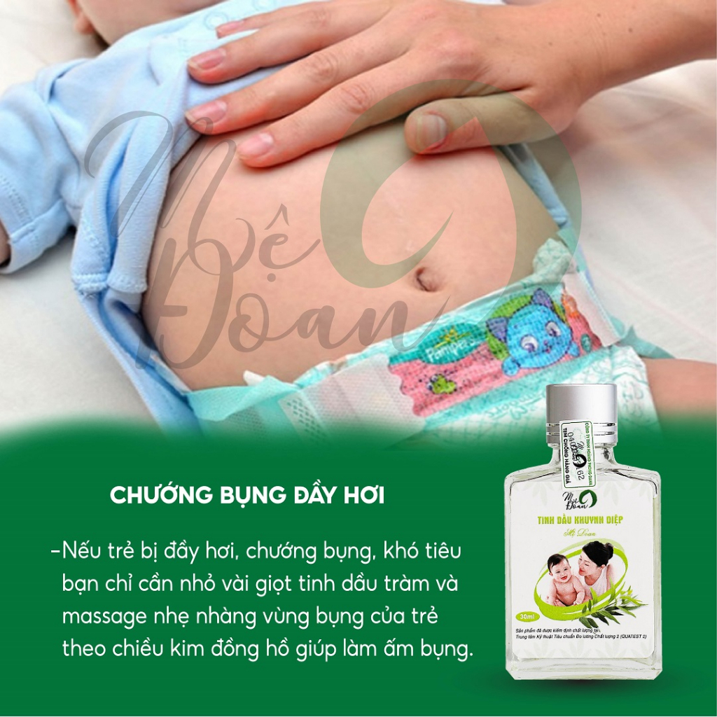 Tinh dầu khuynh diệp củ nén giữ ấm phòng cảm lạnh ho sổ mũi 30ml Mệ Đoan