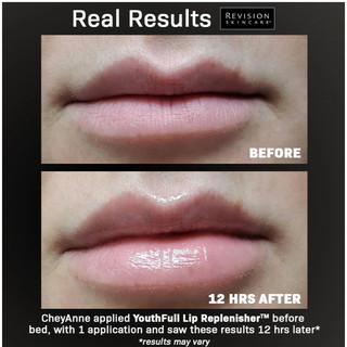 Son Dưỡng Môi Revision Giúp Căng Mọng, Mịn Màng Revision Skincare Youthfull Lip Replenisher 9.4g