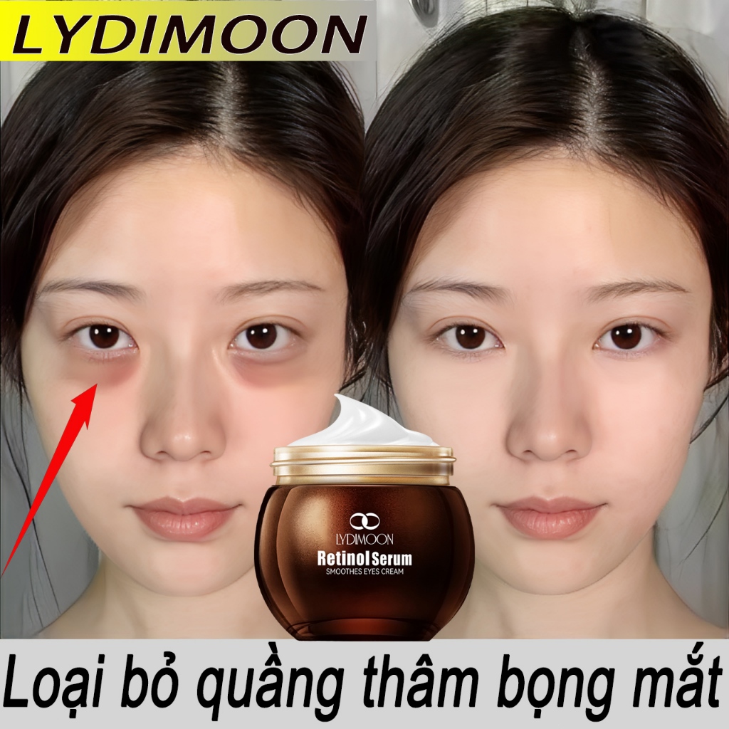 Kem Dưỡng Mắt Serum Chăm Sóc Vùng Mắt - Hình Ảnh Thực Tế