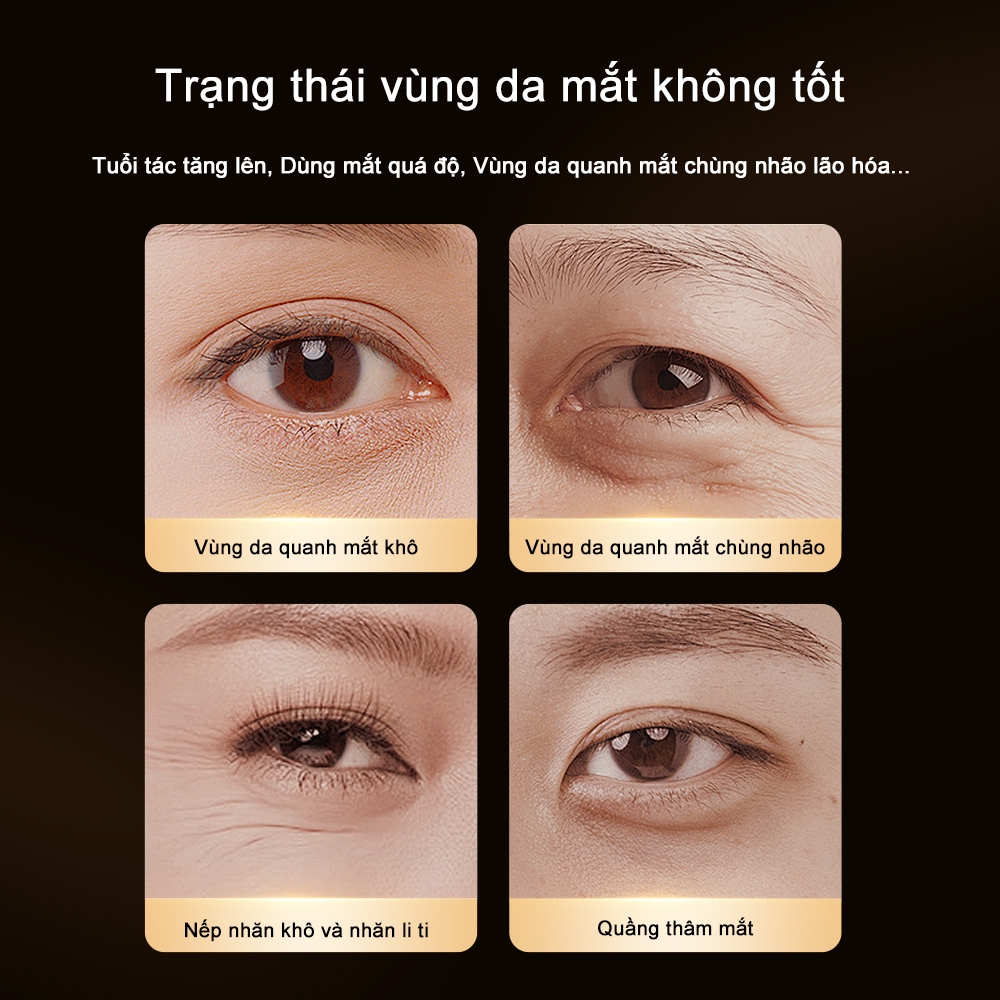 Thiết Kế Của Tuýp Túi
